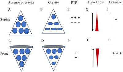 Frontiers The Application Of Awake Prone Positioning Among Non